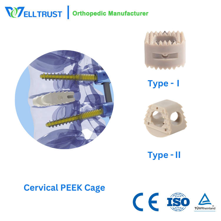 Peek Interbody Cage Provides Support For Spinal Fusion