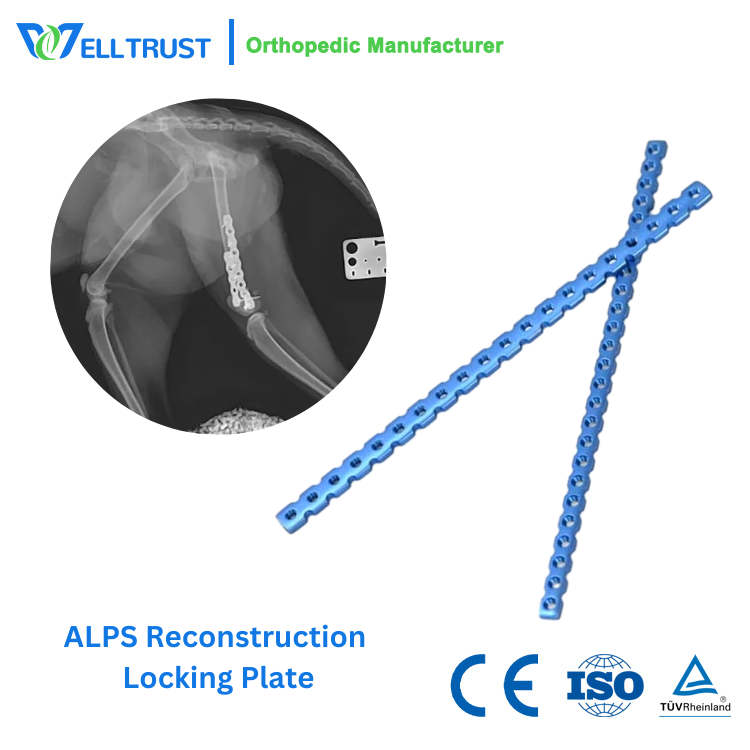 ALPS Reconstruction Locking Plate