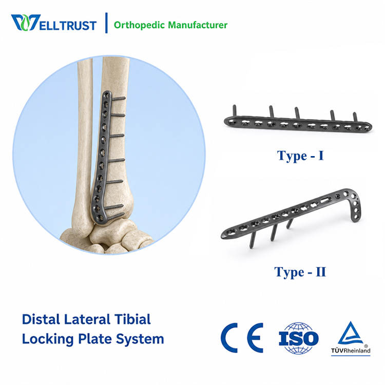 Distal Lateral Tibial Locking Plate