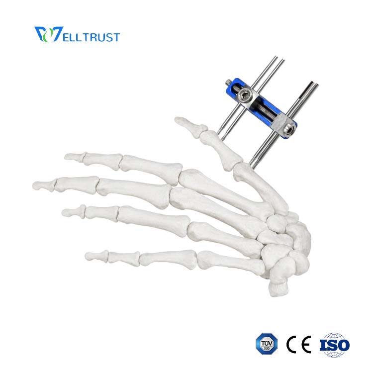 Mini External Fixator - Straight Track Type